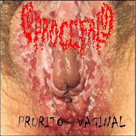 Prurito Vaginal